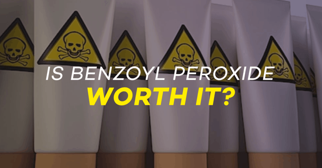 acne blog, clear skin, how to get rid of acne, does benzoyl peroxide work